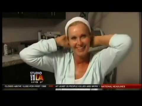 Dr. Behroozan performs Ultherapy on Fox 11 News